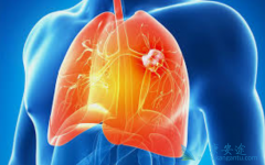 �뼪��������ȴ���������Ʒ�Сϸ���ΰ��ɸ����ߴ�������PFS����