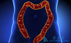 ߻������������ƽ�ֱ������Ч����Σ�