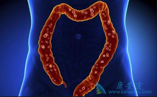 结直肠癌 结直肠癌