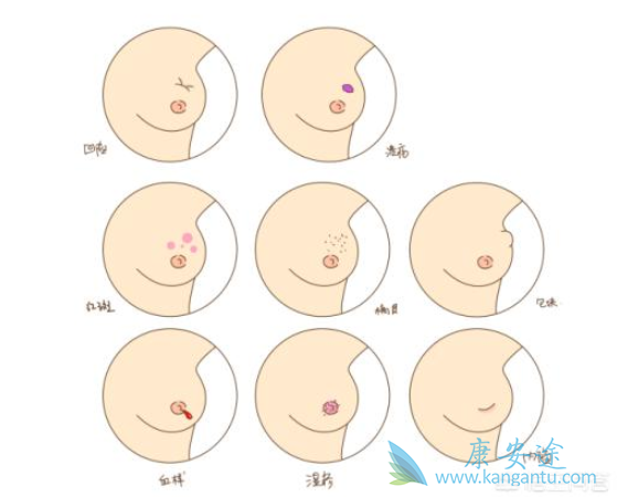 乳腺区域划分图片图片