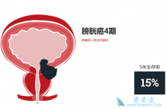 TecentriqΪ���װ������ṩһ����Ҫ������ѡ��