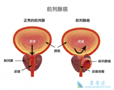 ǰ���ٰ��ķ���ԭ���ǰ���ٰ�������ô�Σ�