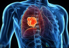 �������������EGFR��HER2����20�������Ӳ���ͻ��ΰ����ߵĿ���