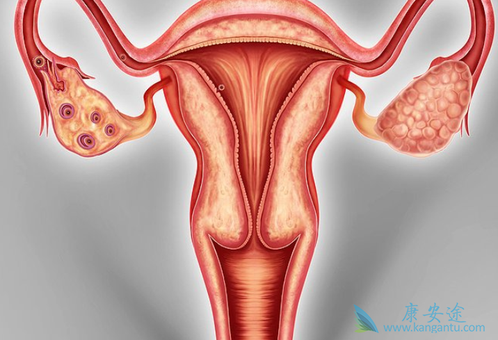 brca卵巢癌 brca卵巢癌