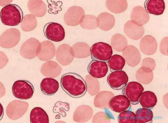 �����ܰ�ϸ����Ѫ�����Բ�ʹ�û�����