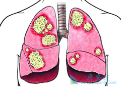 �ΰ������ֶ�����Щ