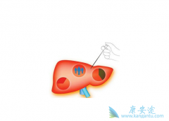 �Ҹ����ڸ�Ӳ����ʲôҩ�ã�