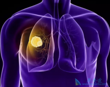 �ΰ������ܻ��ã�