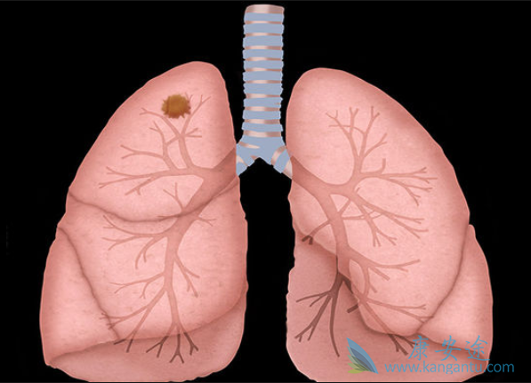 1564710179103302.png image.png