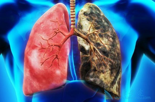 肺癌高发的因素 肺癌高发的因素