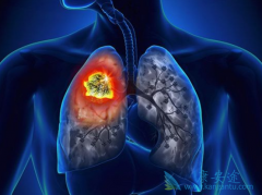 ���۰��������Ʒ������ѡ��