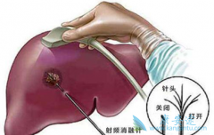 �Ҹ���ʲô����