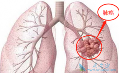 ʲô�Ƿ�Сϸ���ΰ���