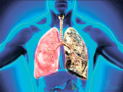 预防肺癌复发 预防肺癌复发