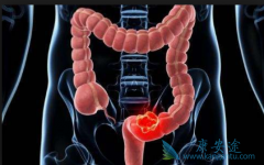 Ϊʲô��ֱ����������ȺԽ��Խ���ữ��