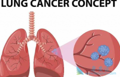 �β��������κ���