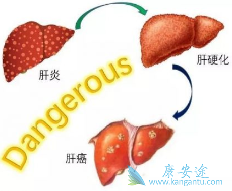 乙肝耐药 乙肝耐药