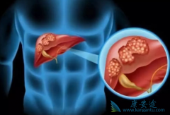 Ԥ�����δ����ķ�������Щ��