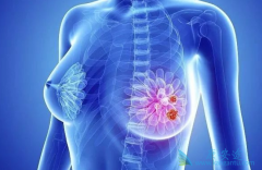 ���������ٰ���ô���ƱȽϺã�