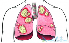 �ΰ��������κõ���