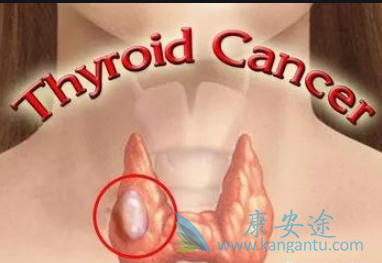 甲状腺肿瘤 甲状腺肿瘤