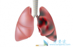 �ΰ�����֢״����Щ���֣�