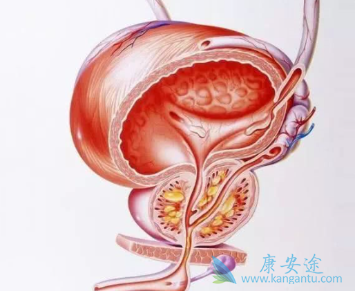 前列腺癌骨转移 前列腺癌骨转移