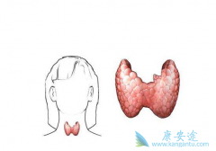 ��״����������Ҫ�����״������