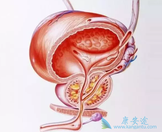 前列腺癌骨转移 前列腺癌骨转移