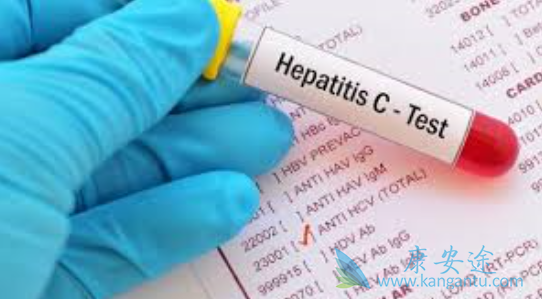 丙肝炎早期症状 丙肝炎早期症状
