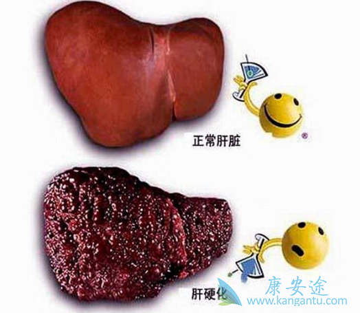 什么是丙肝 什么是丙肝