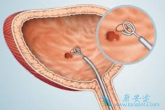 �����������ת���԰��װ���ORR�ɴ�40%