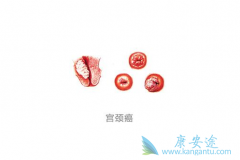 ���������粻�ܸ������еĹ�����ԭ��