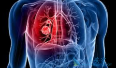 �ΰ��������κ��𣿷ΰ��������Ʒ�������Щ��