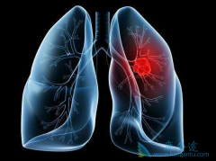 ���¶�ɯ����(Ensartinib)��ҩ��ͻ������Щ��