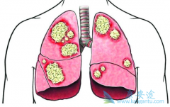 ���ڷΰ����ư취��ʲô��