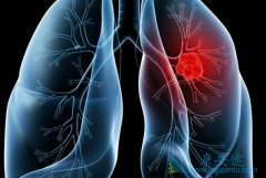 �ΰ��������ƺ��ܻ��ã�