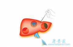 ��η�ֹ�����Ҹ����ƺ󸴷���