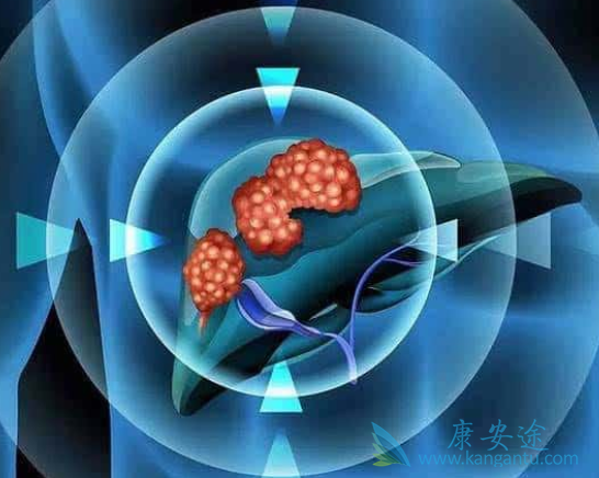 乙肝大三阳 乙肝大三阳