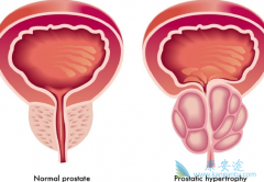 ǰ���ٰ����Ʒ����͸�����