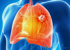 �ΰ�EGFRҩ�ﶼ����Щ��