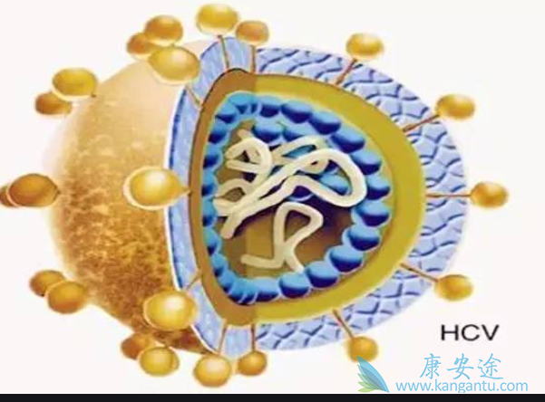 难治性丙型肝炎 难治性丙型肝炎