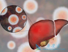 �Ҹβ�����Ⱦ�������ĸ�Ӳ����������ƣ�