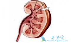 ������ϸ������һ�����Ʋ�������Щ��