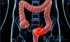 ��ֱ�������Ʒ���������Щ��