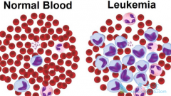 ��Ѫ�������Ʒ�����ʲô��Ч����Σ�