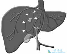 ��Щ��Ϊ�������Ⱦ�ϱ��β���?���εĴ���;������