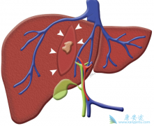 �����������𣿱��͸�������Ч����Σ�