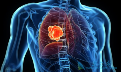 �ΰ�EGFRҩ�������ڼ�������Щ������Ӧ��