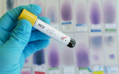 һ��Ӵ��ᵼ�±��δ�Ⱦ�𣿱��δ���;����Ҫ��Ѫ